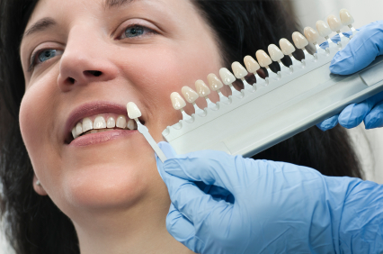 A dentist matching tooth color before a tooth bonding procedure