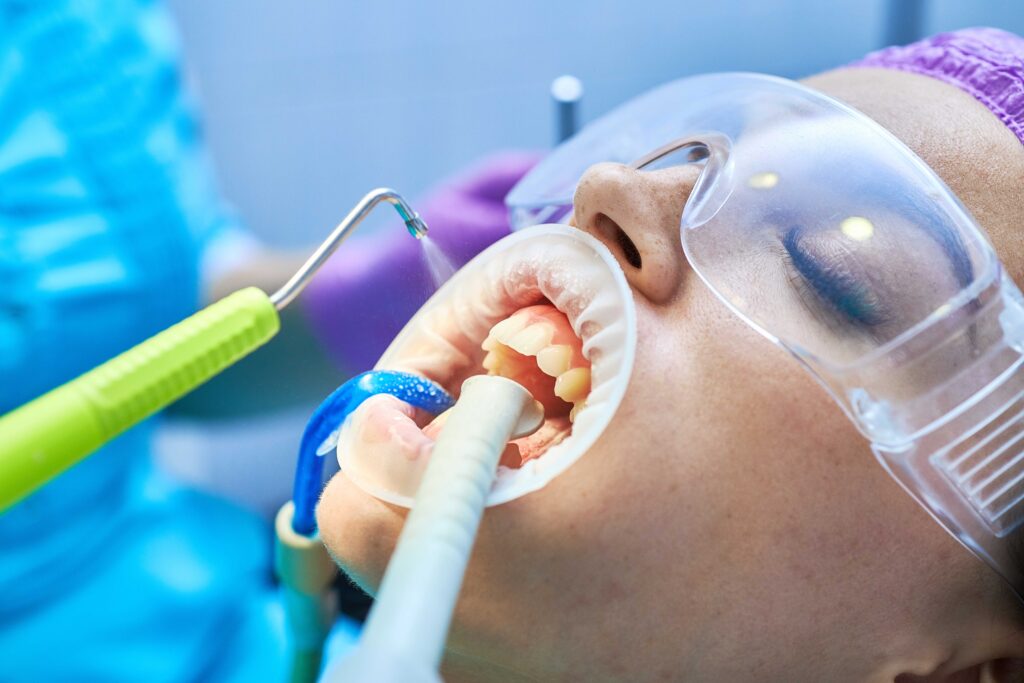 air abrasion tools being used during a dental procedure. 
